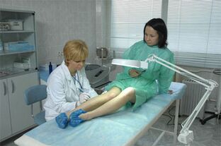 Laser therapy for varicose veins in the legs