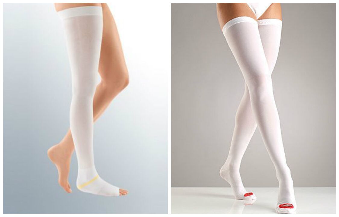 compression stockings for varicose veins