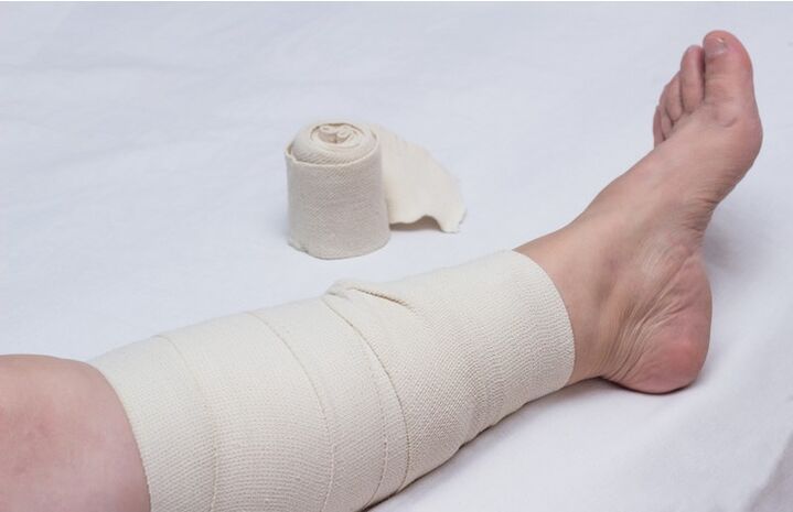 leg compression bandage for varicose veins