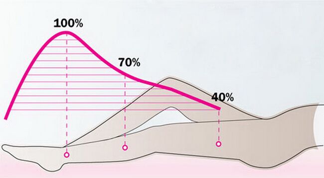 Scheme of gradual reduction in pressure of compression garments on legs affected by varicose veins