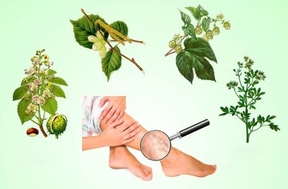 Herbs for the treatment of varicose veins in the legs