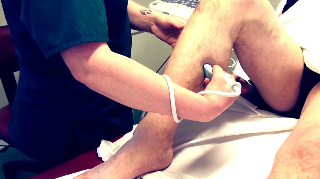 Duplex scanning of lower extremity veins for the diagnosis of varicose veins